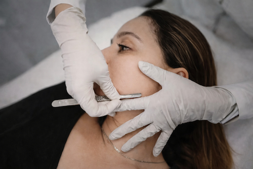 Dermaplaning